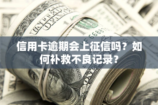 北京信用卡逾期会上征信吗？如何补救不良记录？